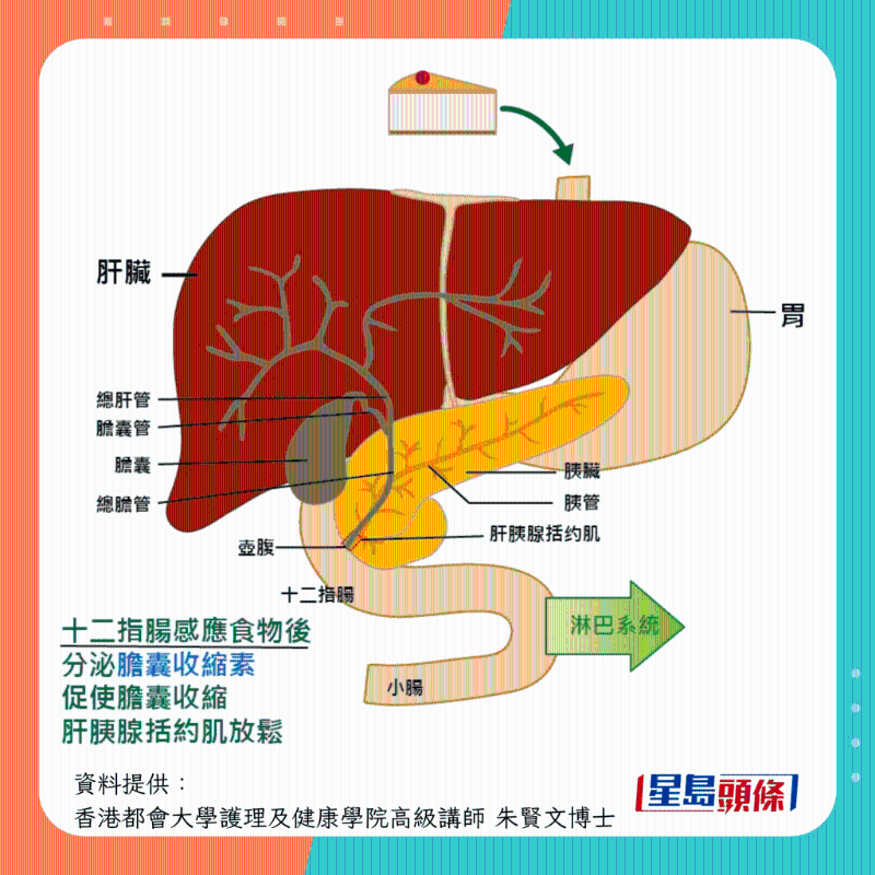 膽結石形成過程