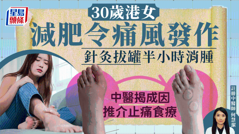 港女減肥引發痛風，中醫治療30分鐘消腫，揭4方法預防痛風